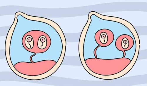 试管双胎都容易出血吗？试管婴儿移植后六天出血怎么办？